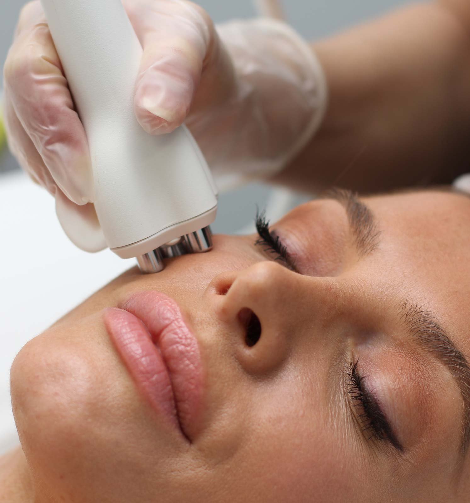 Laser skin treatment rejuvenation Spring TX